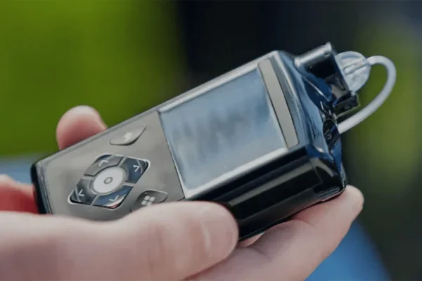 INSULIN PUMP